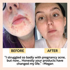 Up Circle Face moisturizer
