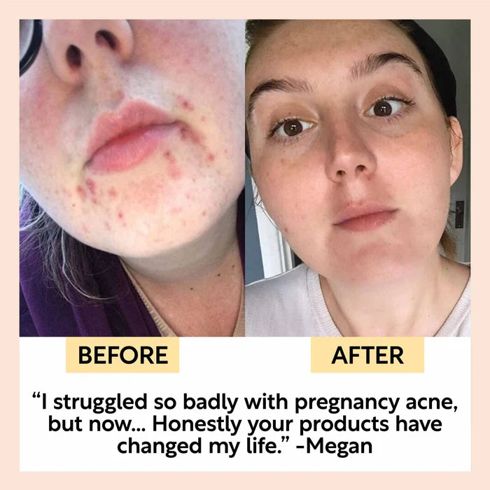 Up Circle Face moisturizer