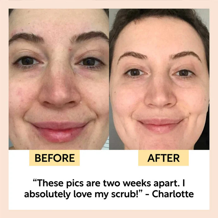 UpCircle gezichtsscrub met rozenbottelolie