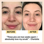 UpCircle gezichtsscrub met rozenbottelolie