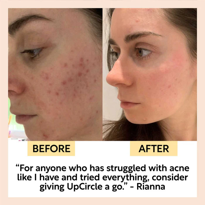 Up Circle Face Toner